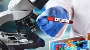 Corona virus